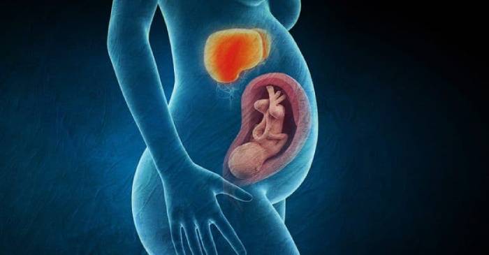 کبد چرب در بارداری